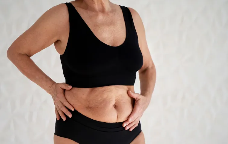 Mulher segurando a região abdominal, ilustrando o inchaço e desconforto que podem ser causados pelo consumo excessivo de bicarbonato de sódio.