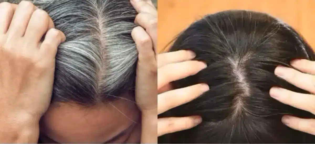 Comparação antes e depois do uso de um tonalizante natural para cobrir cabelos brancos