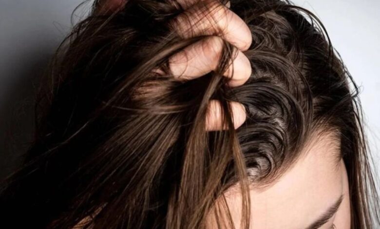 Mão puxando cabelo com oleosidade visível no couro cabeludo, destacando a área com mais sebo.