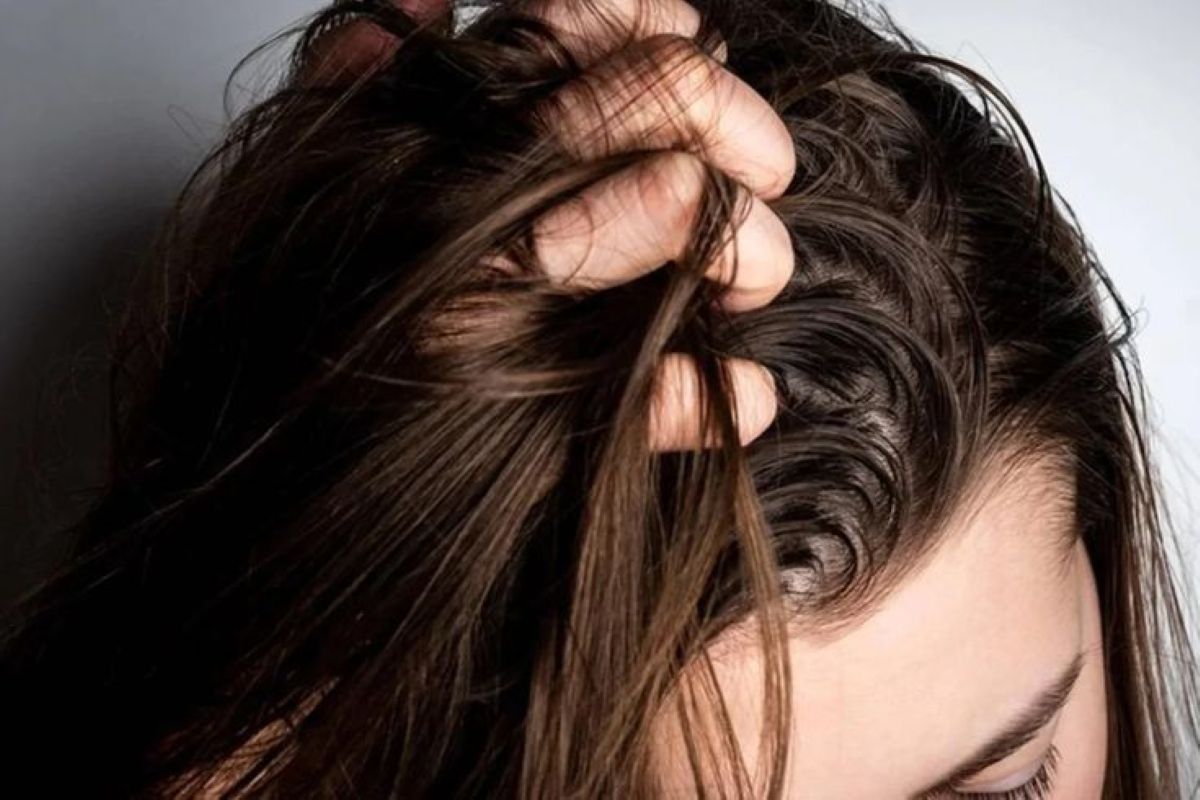 Mão puxando cabelo com oleosidade visível no couro cabeludo, destacando a área com mais sebo.