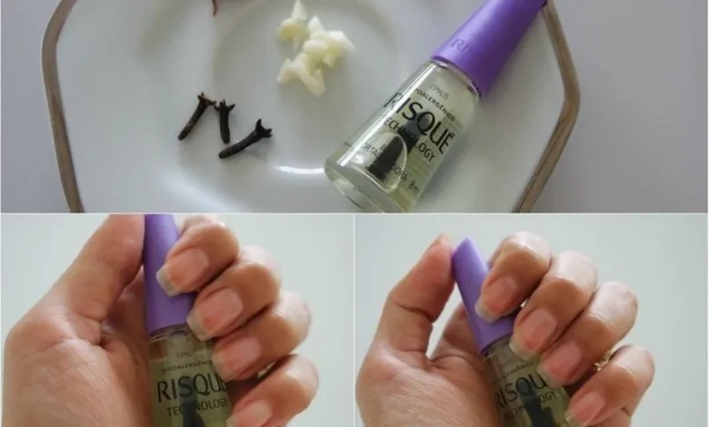 Fortalecedor de unhas caseiro com cravo e alho mostrando frasco e unhas naturais
