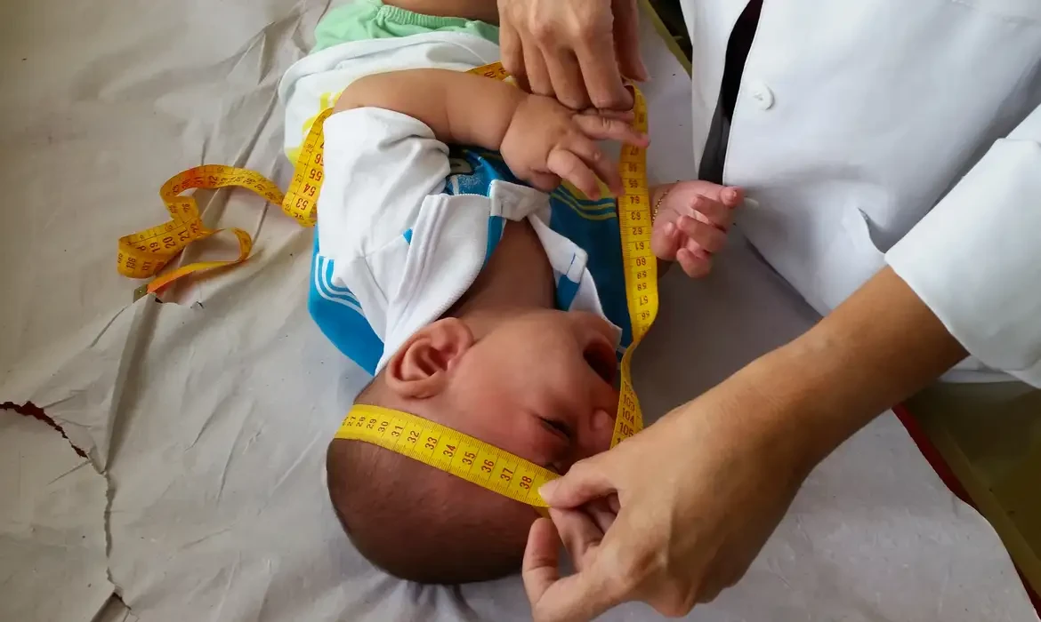 Profissional de saúde medindo a cabeça de um bebê, avaliação para deficiência causada pelo vírus Zika.
