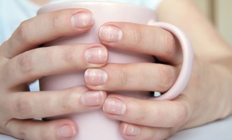 Mãos femininas segurando uma caneca rosa, com unhas naturais mostrando manchas brancas.