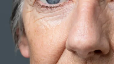 Close-up do rosto de uma mulher idosa, com foco nas linhas de expressão e na textura da pele, simbolizando os efeitos do envelhecimento.