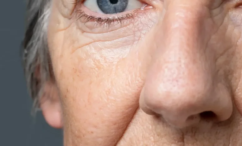 Close-up do rosto de uma mulher idosa, com foco nas linhas de expressão e na textura da pele, simbolizando os efeitos do envelhecimento.