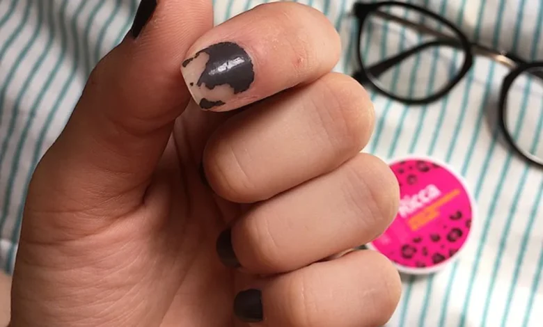 Unha com esmalte descascando, mostrando erro na aplicação.