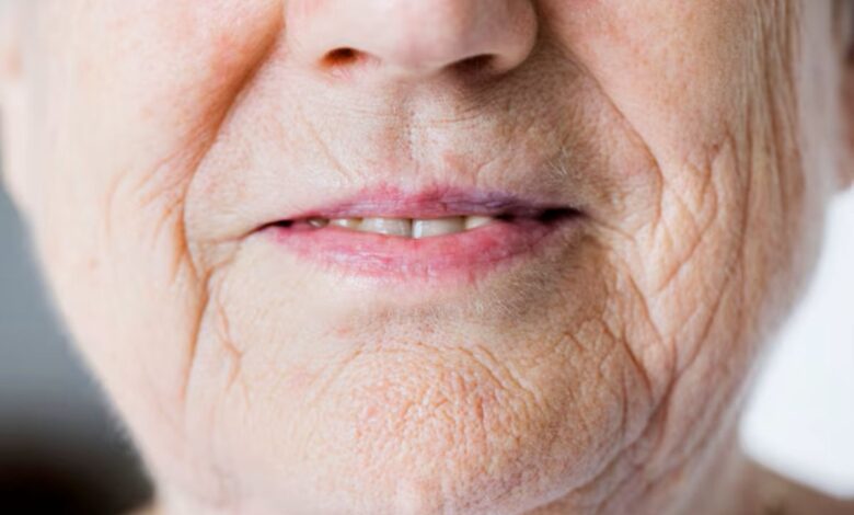 Close-up da boca de uma pessoa idosa, destacando o ressecamento da pele ao redor dos lábios e a gengiva, como um sinal de alerta para o diabetes.